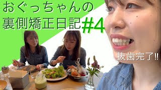 おぐっちゃんの裏側矯正日記♯4