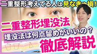 【二重埋没法】何点留めが良いの？二重整形のプロが徹底解説！