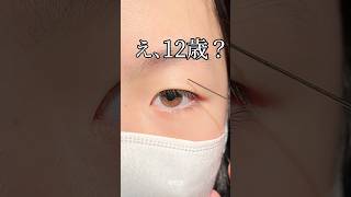 【二重整形】え、12歳？👀💥 #shorts