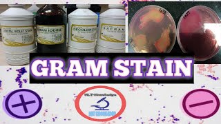 gram staining_gram staining procedure_gram staining procedure steps_gram staining practical