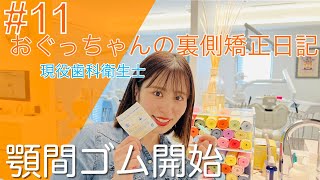 #11 現役歯科衛生士おぐっちゃんの裏側矯正日記