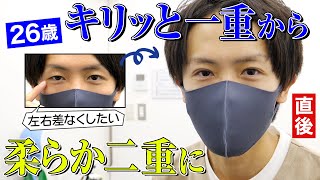 【二重整形】埋没法クイックコスメティーク・トリプルでイケメン度アップ！？【メンズ整形】
