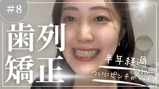 [#8 Jaw Deformity] After six months of orthodontic treatment, I'm finally in trouble!? I thought ...