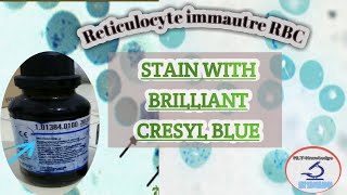 How to stain Reticulocytes count_ Reticulocytes stain procedure_reticulocyte count full detail
